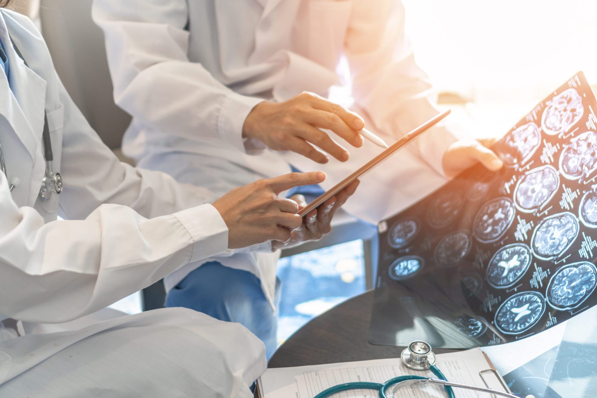 Los Angeles Brain Injury Lawyer
